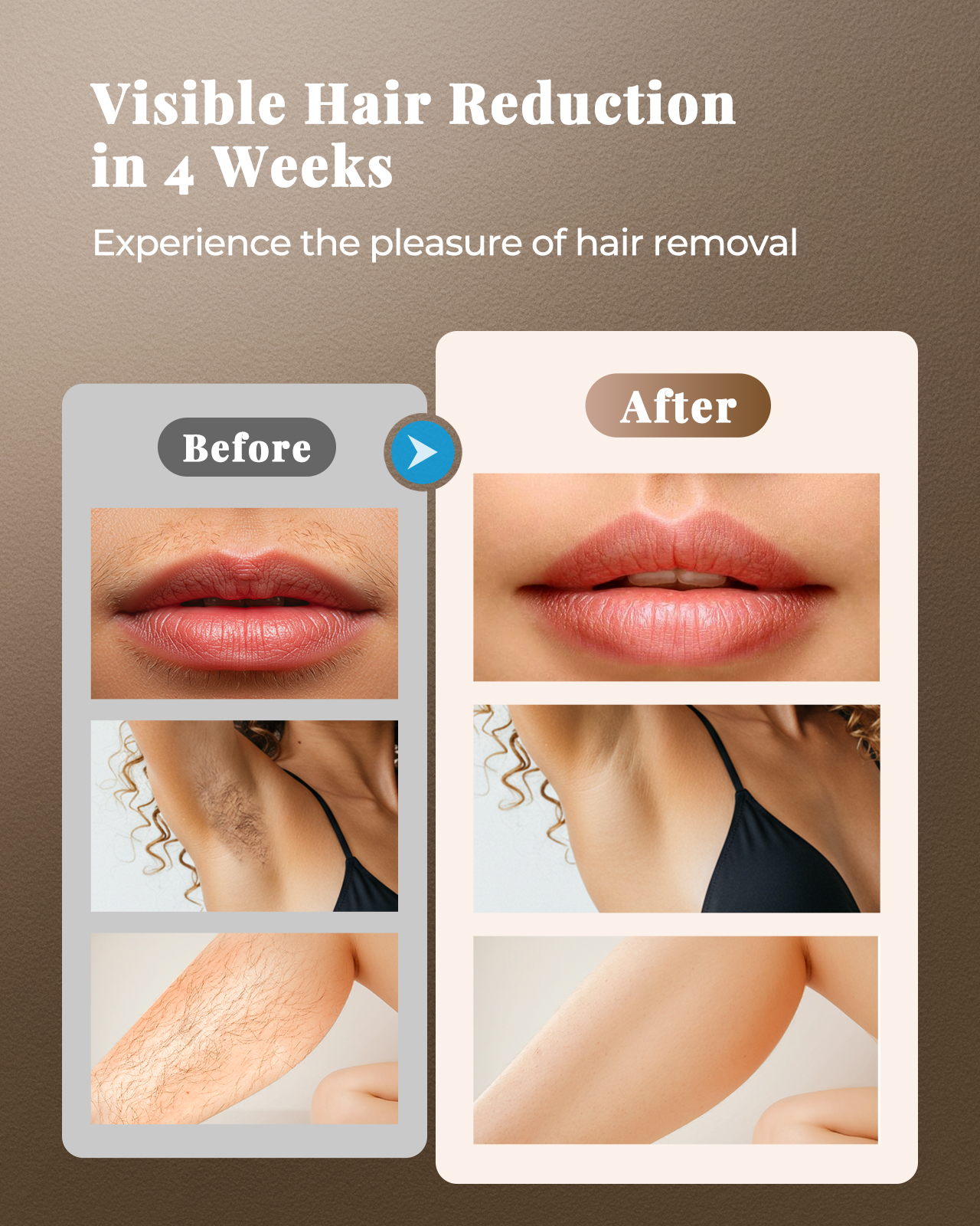 2026 IPL Skin Rejuvenation Fac - đánh giá và giá Hair Care Homemade